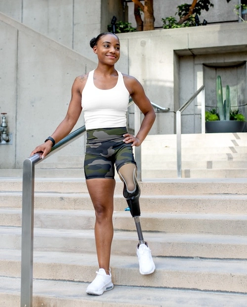 Confident woman with prosthetic leg
